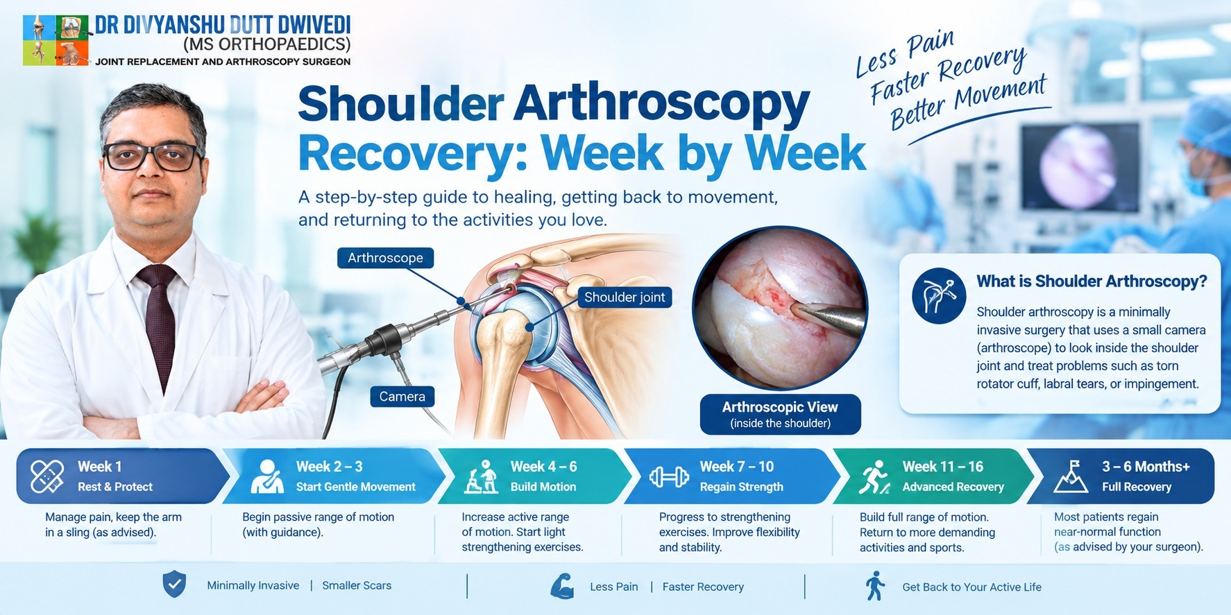Shoulder Arthroscopy Recovery: Week-by-Week Guide