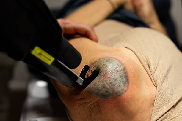 Our Services | SRK Skin & Laser Centre Sonipat